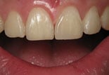 image of business Bainbridge Dental Care