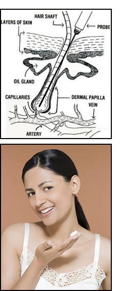 Electrolysis Just For You