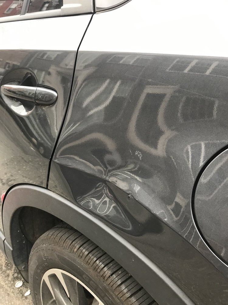 Dent Tekniks
