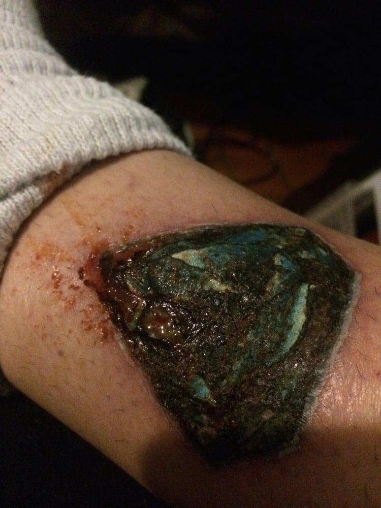 thank you bella arte for my wonderfully infected tattoo thank you bella arte for my wonderfully infected tattoo