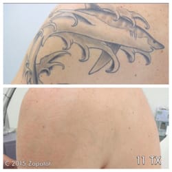 zapatat 106 photos u0026 67 reviews tattoo removal 820 n pollard zapatat 106 photos u0026 67 reviews tattoo removal 820 n pollard