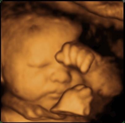 Joseph Talcott DO, PC