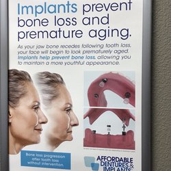 Affordable Dentures Implants 31 Reviews General Dentistry Photo Of Affordable Dentures Implants Las Vegas Nv United States