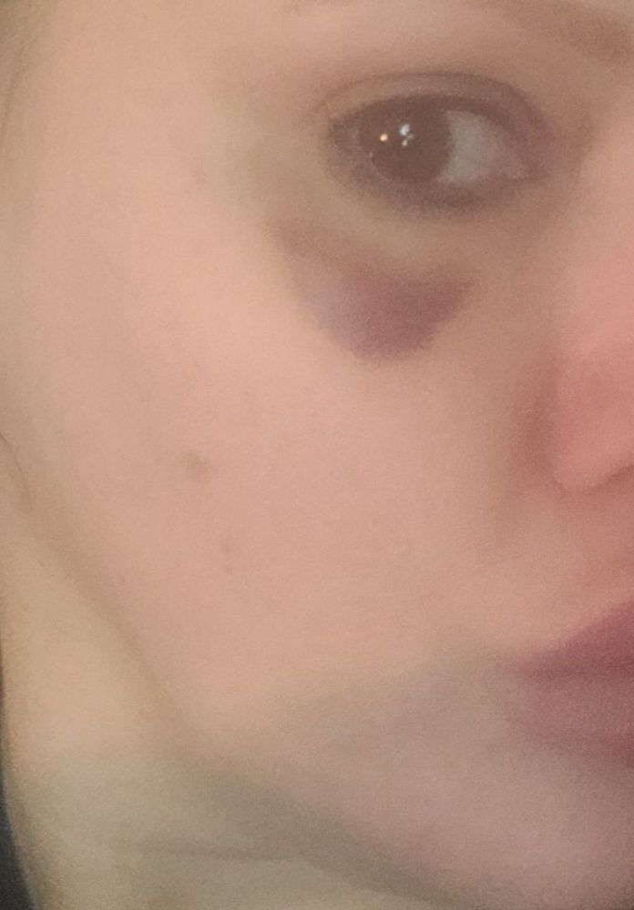 Charlotte Plastic Surgery