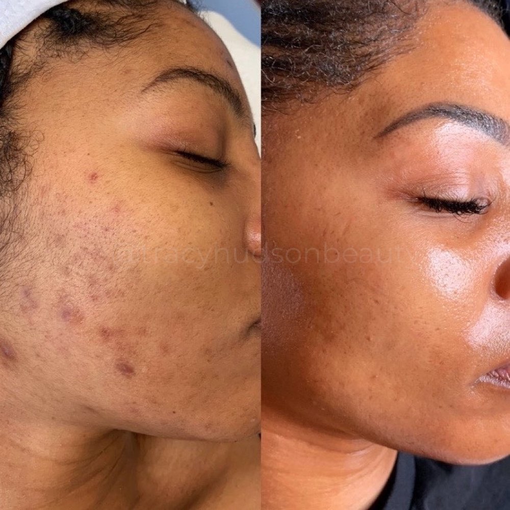 Tracy Hudson Skin Care