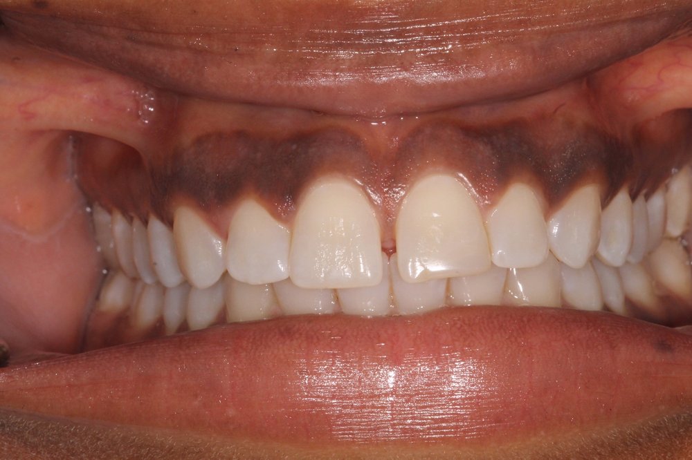 image of business Ballantyne Dentistry