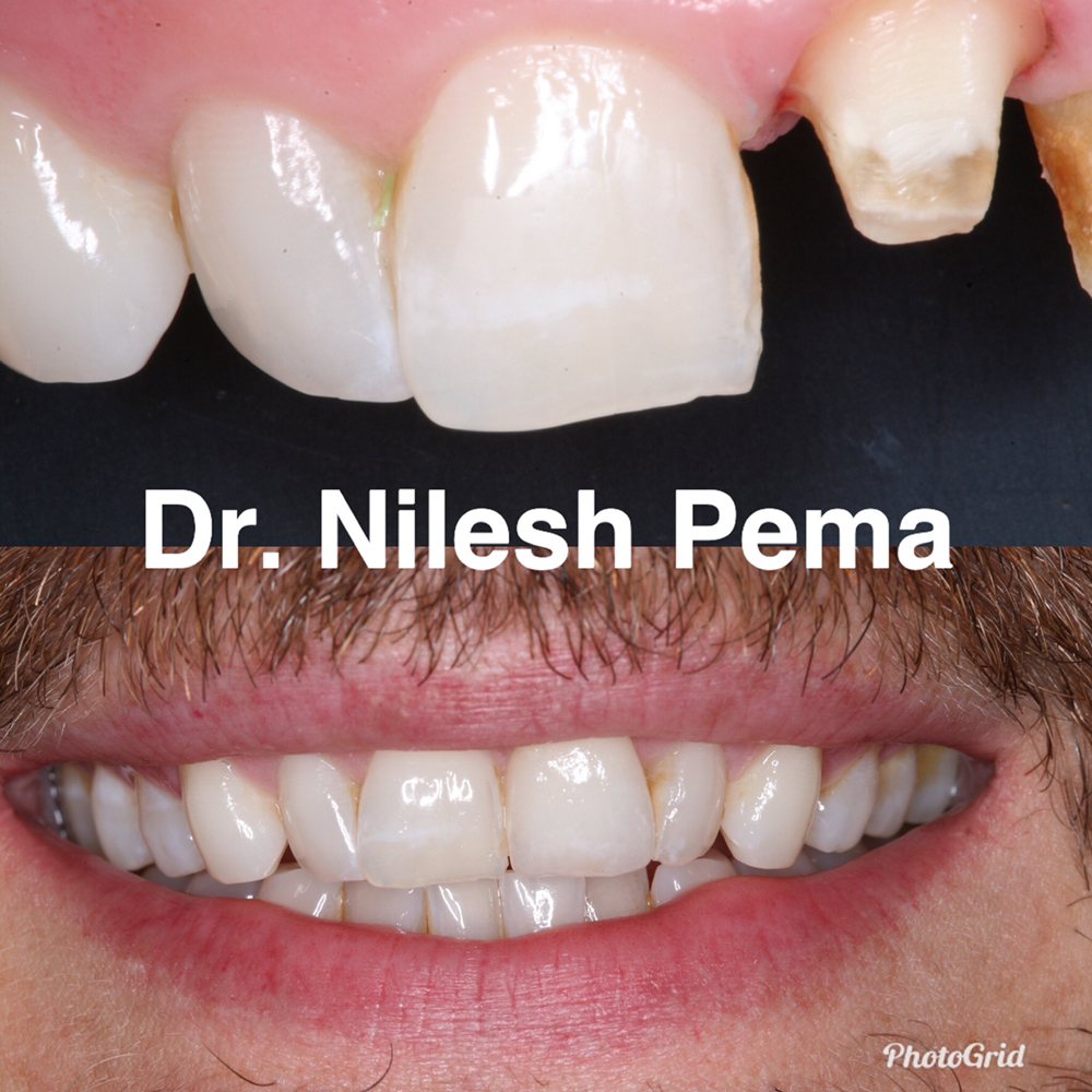 image of business Dr. Nilesh Pema DDS