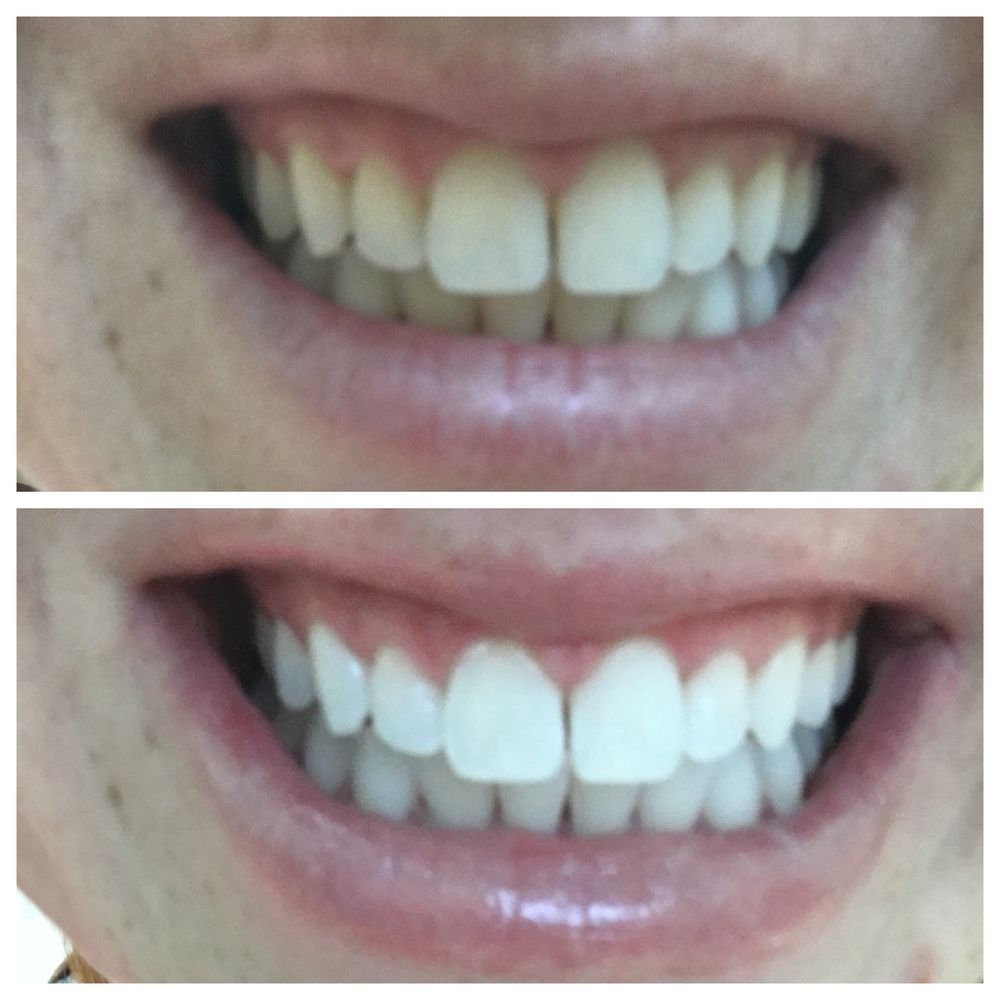 Bensalem Smiles 4 U Dental Care