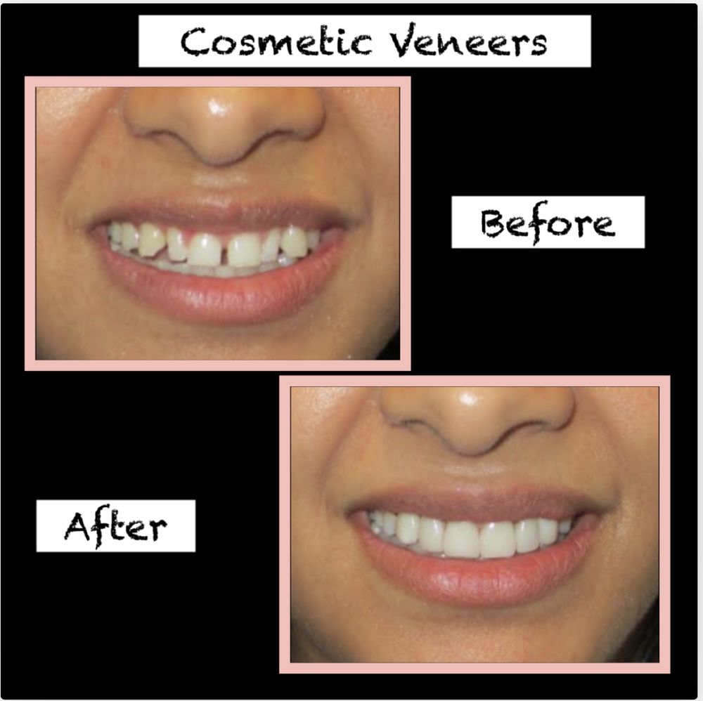 image of business Newport Smiles