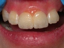 image of business Northpointe Dental Care