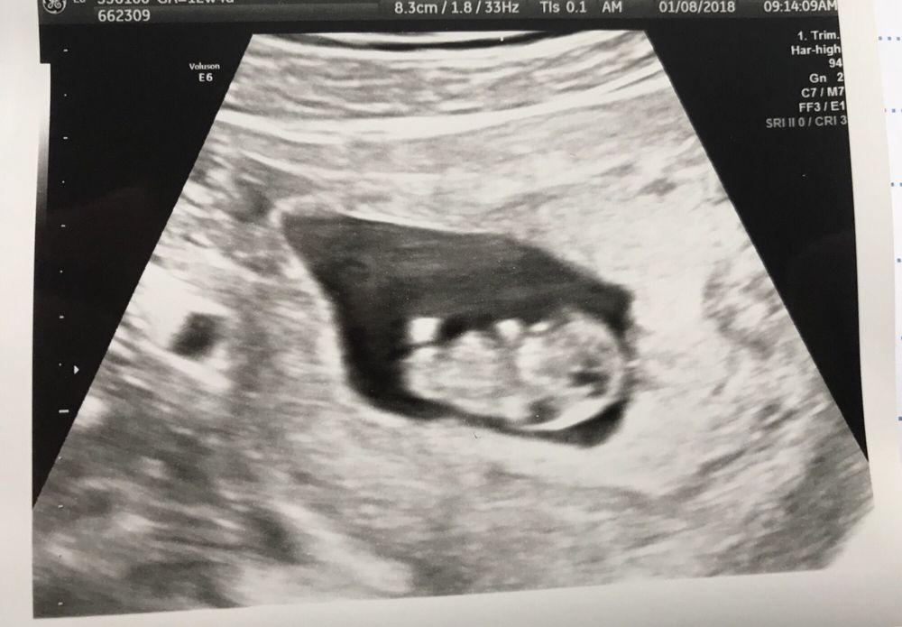 Tate Diagnostic 44 Photos & 26 Reviews Diagnostic Imaging 1524