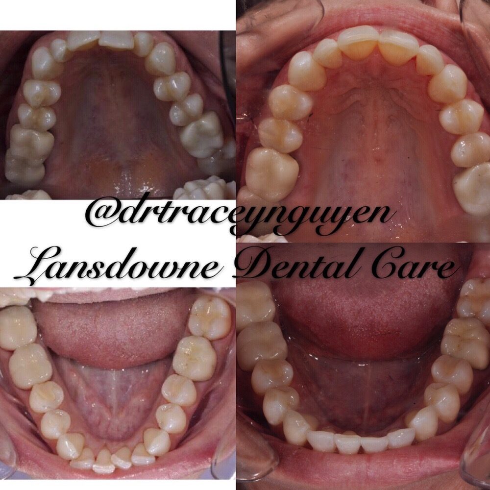 Lansdowne Dental Care