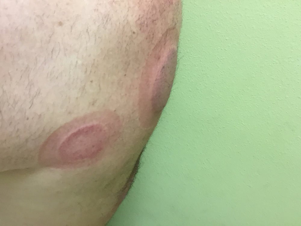 O