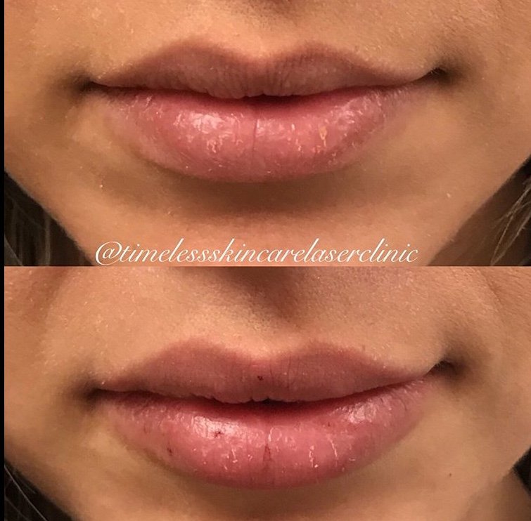 timeless skin care laser clinic