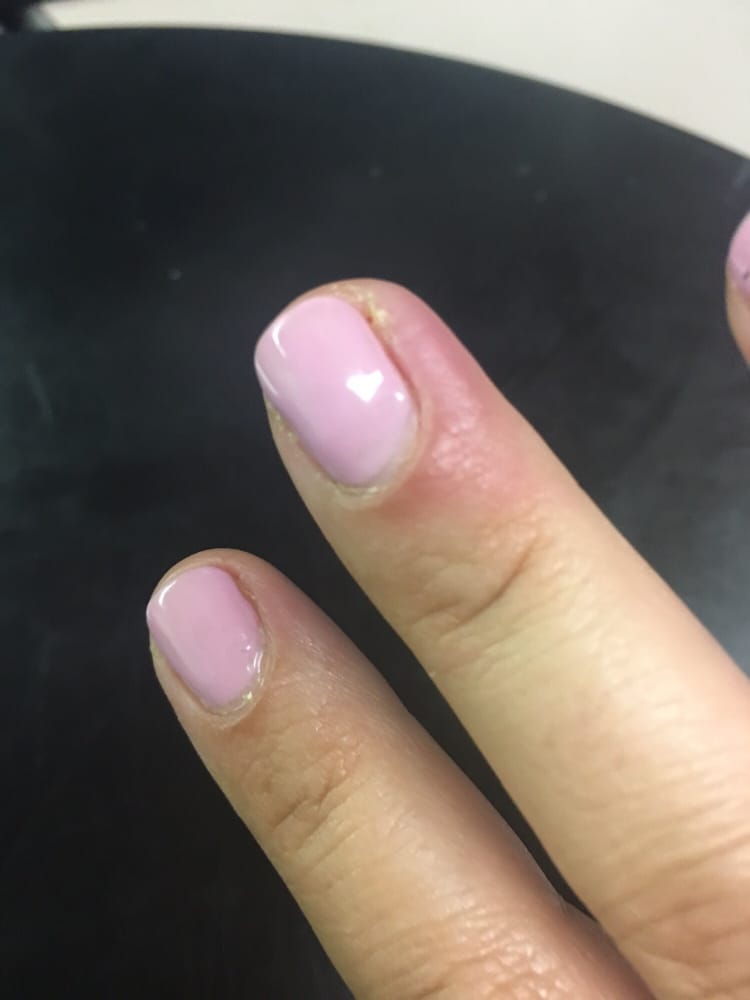 I Got An Infection At This Nail Salon It S Been A Week Since Went Photo Of Top Gel Nails Spa Sacramento Ca United States I