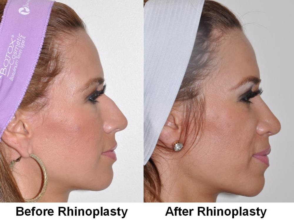 Best of Facial plastic surgeon texas texas surgeon Facial plastic