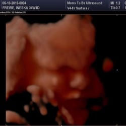 ultrasounds orlando