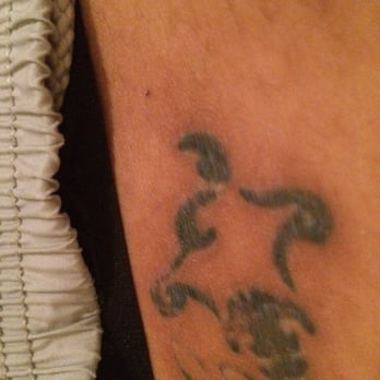 eliminate tattoo removal tattoo removal 909 s allante ave eliminate tattoo removal tattoo removal 909 s allante ave