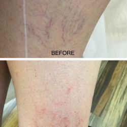 park slope laser aesthetic center 56 photos u0026 44 reviews laser park slope laser aesthetic center 56 photos u0026 44 reviews laser