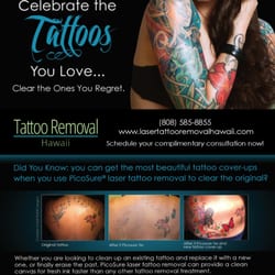 laser tattoo removal hawaii 23 photos tattoo removal 1401 s laser tattoo removal hawaii 23 photos tattoo removal 1401 s