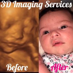 3d ultrasound bronx ny live photo of 3d imaging services bronx ny united states diagnostic ultrasounds 5d 51 photos 3004 3d ultrasound bronx ny live photo of 3d imaging services bronx ny united states diagnostic ultrasounds 5d 51 photos 3004