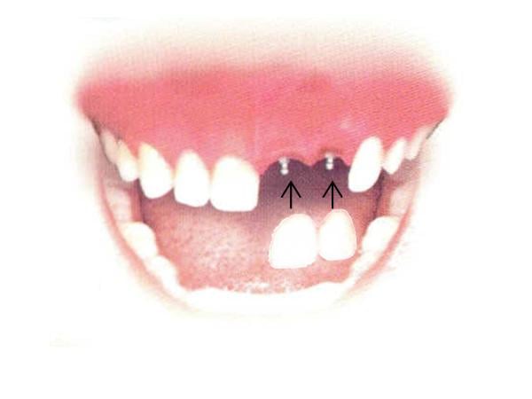 image of business New London Family Dentistry and Implants