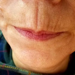 Facial gallows rd vienna va Kimberly clark facial tissue