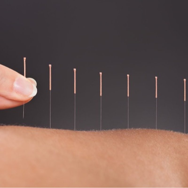 KERN ACUPUNCTURE 11 Photos 5300 Lennox Ave, Bakersfield, CA Yelp