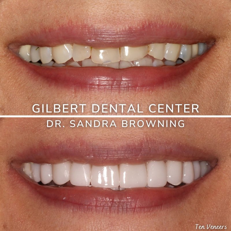 GILBERT DENTAL CENTER 18 Photos & 11 Reviews General Dentistry
