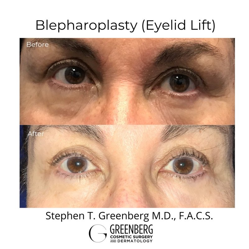 GREENBERG COSMETIC SURGERY MANHATTAN 22 Photos 45 E 72nd St, New