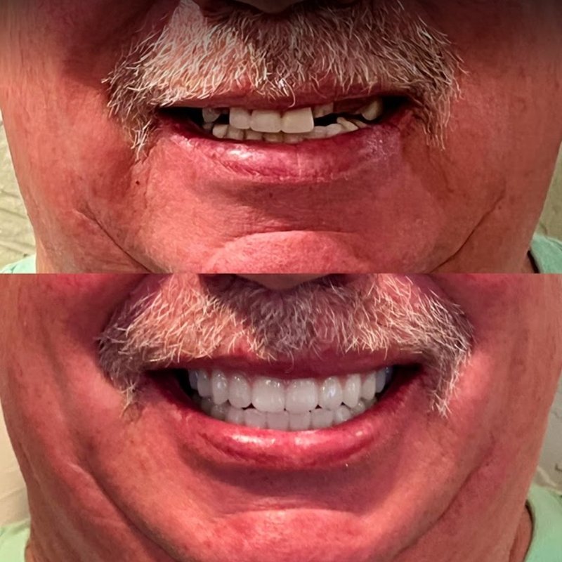 405 IMPLANTS & DENTURES 10001 S Pennsylvania Ave, Oklahoma City, OK Yelp