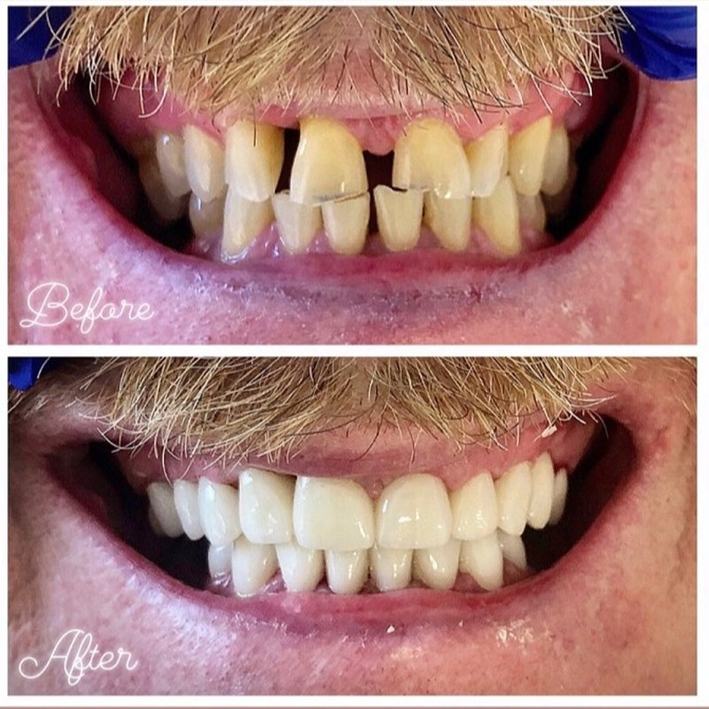 SILVER SPRING DENTAL CENTER 15 Photos Endodontists 10301